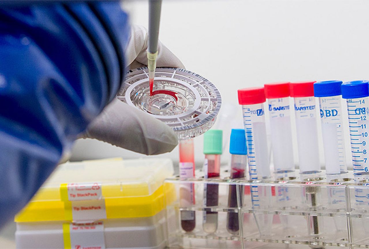 Testirano cjepivo protiv ebole, rezultati obećavajući 