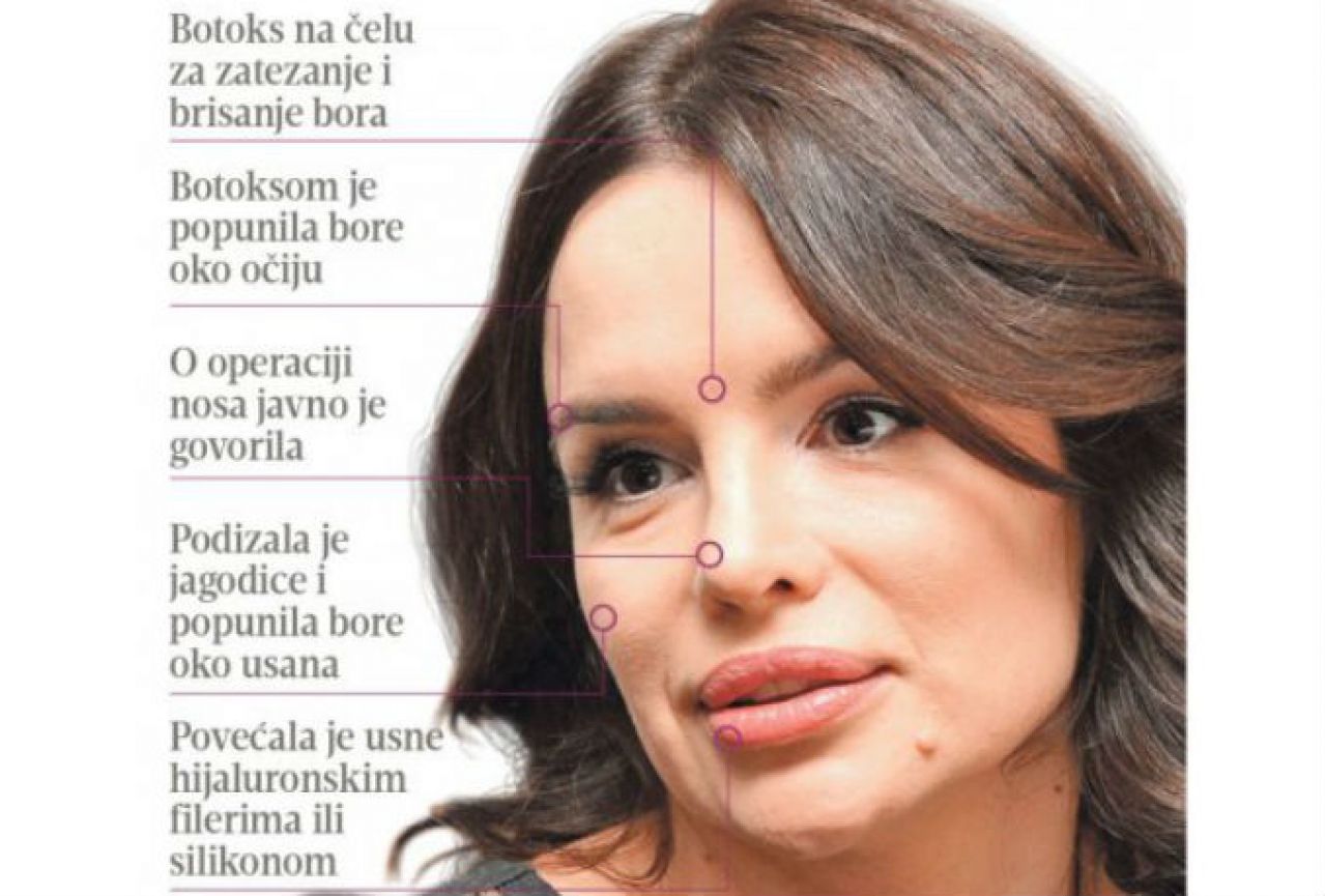 Pjevačice na meti plastičnog kirurga: Na Severininom licu sve je umjetno