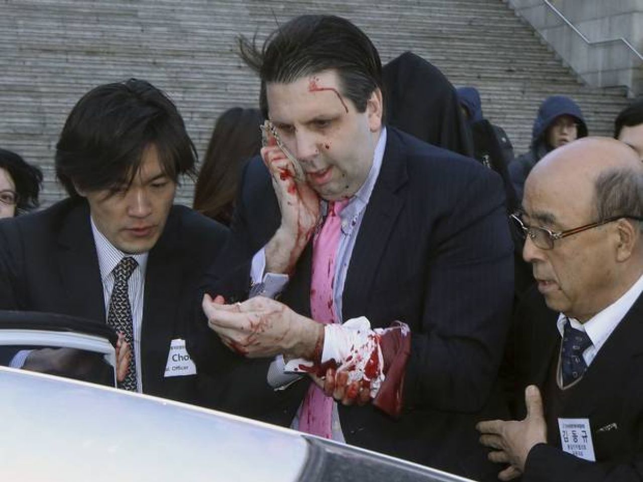 Američki veleposlanik u Južnoj Koreji napadnut britvom