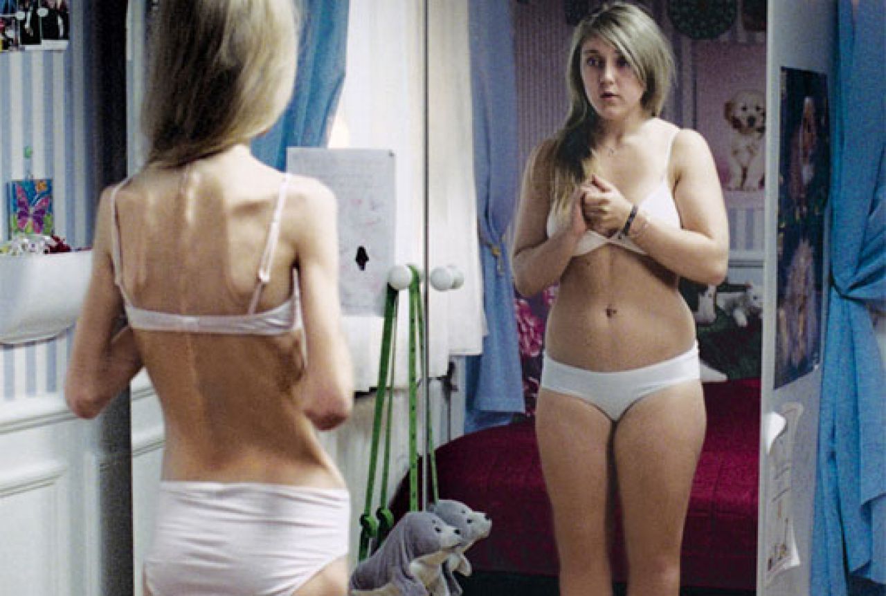 Poticanje na anoreksiju postaje kažnjivo