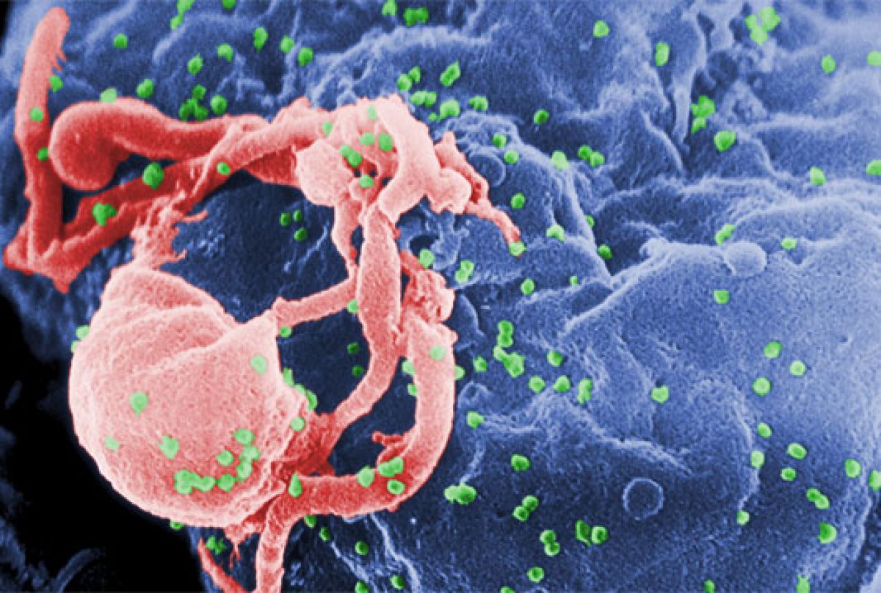 Znanstvenici otkrili molekulu koja može paralizirati HIV