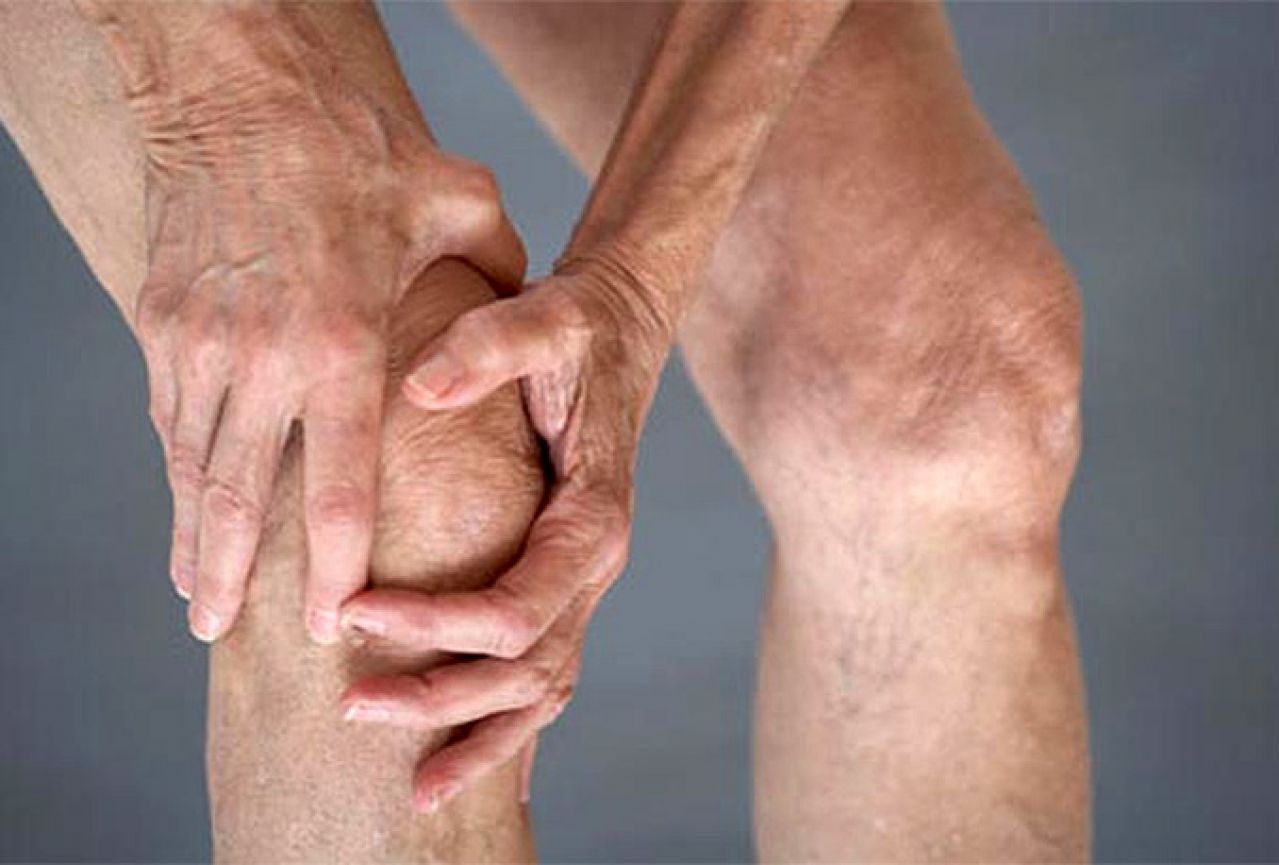 Vlastitim masnim tkivom možete ublažiti simptome osteoartritisa