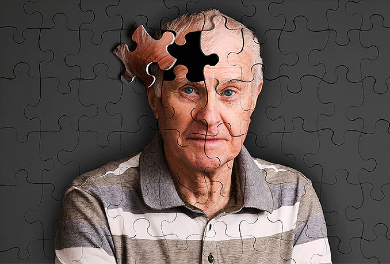 Pretilost korak do Alzhajmerove bolesti