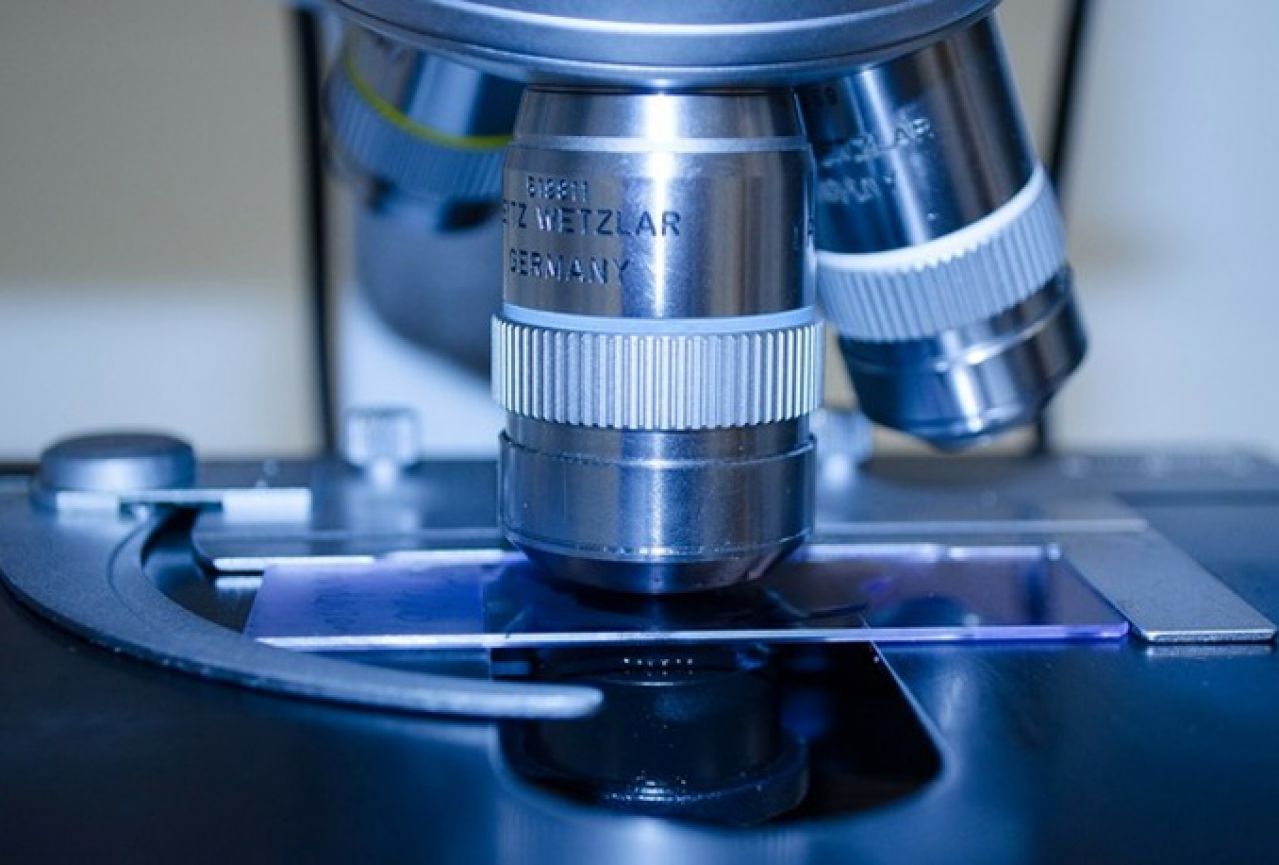 Novi izum: DNK nanostroj detektira HIV u 5 minuta