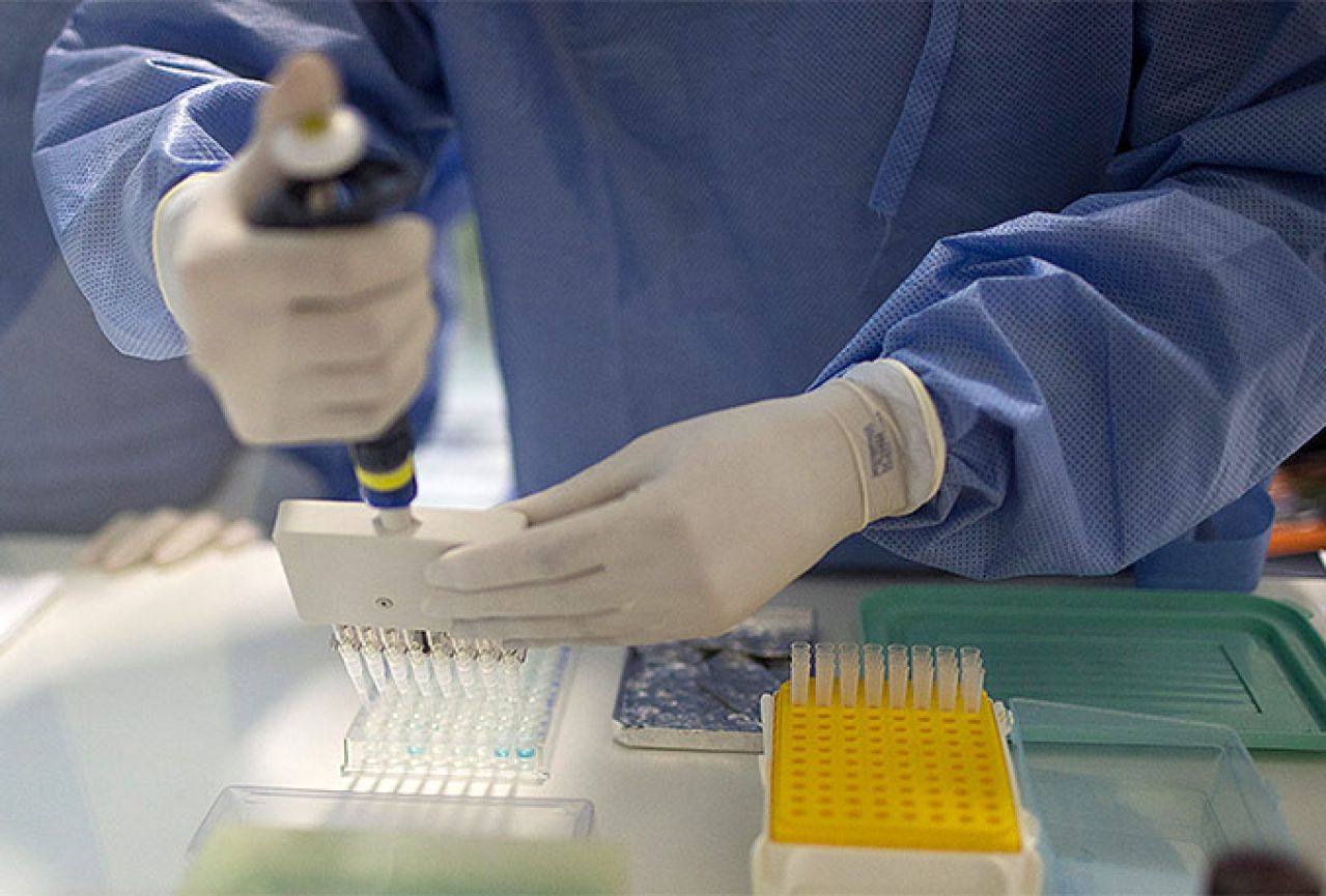 Slovenski znanstvenici  otkrili vezu između virusa zika i mikrocefalije