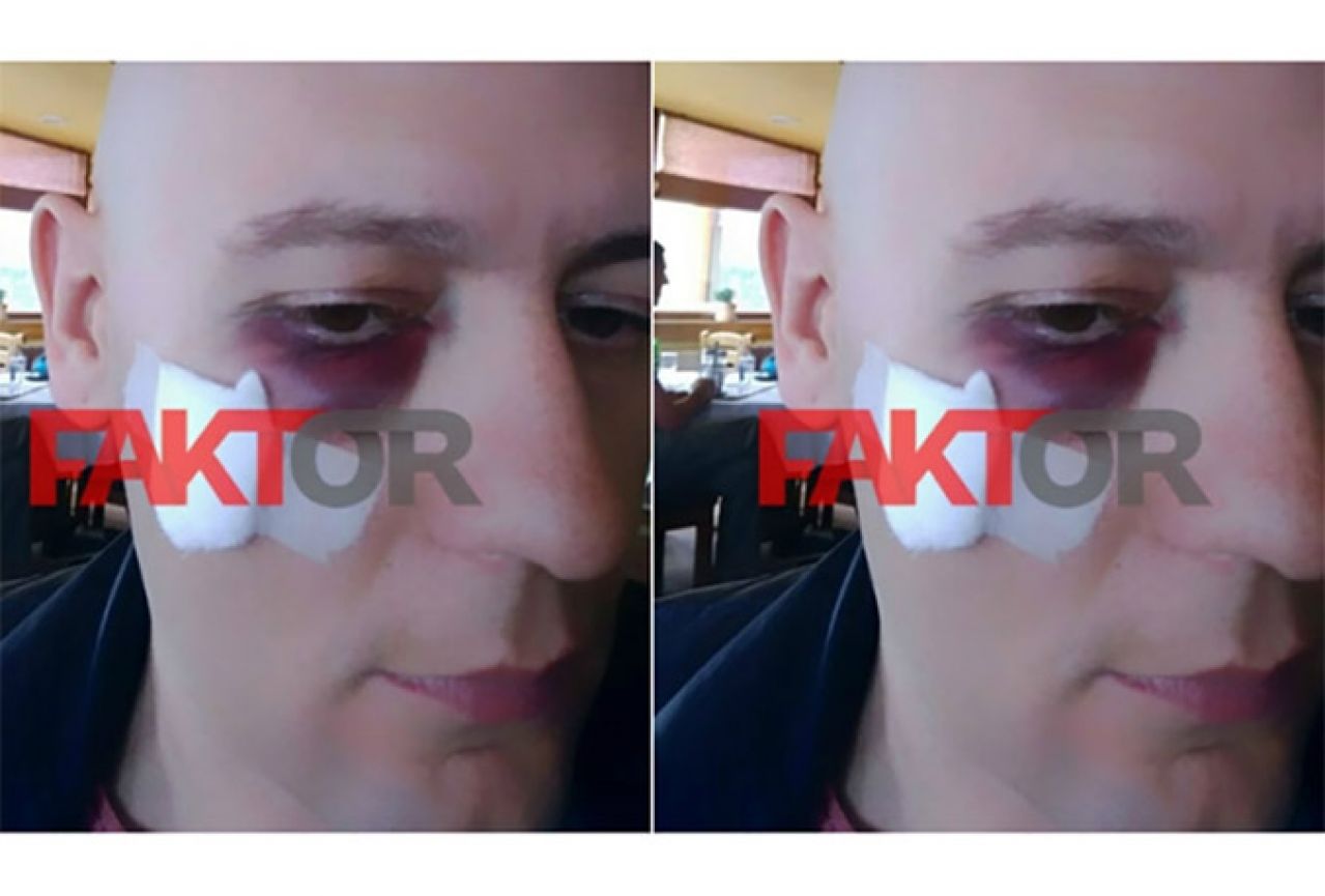 'Kafanska' tučnjava bh. predstavnika na Eurosongu: Reperu Jali slomljen nos
