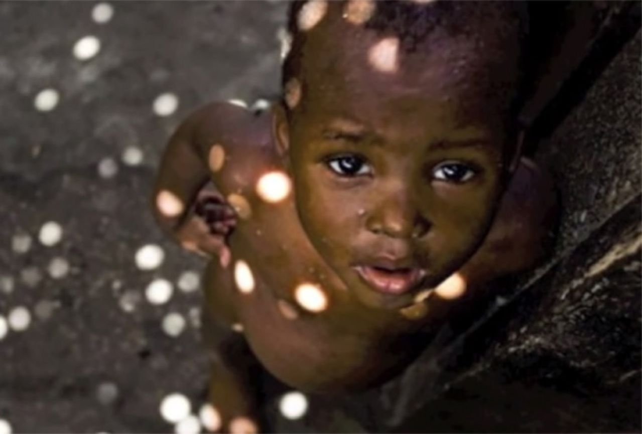 UN: 90 posto djece zaraženo AIDS-om živi u Africi