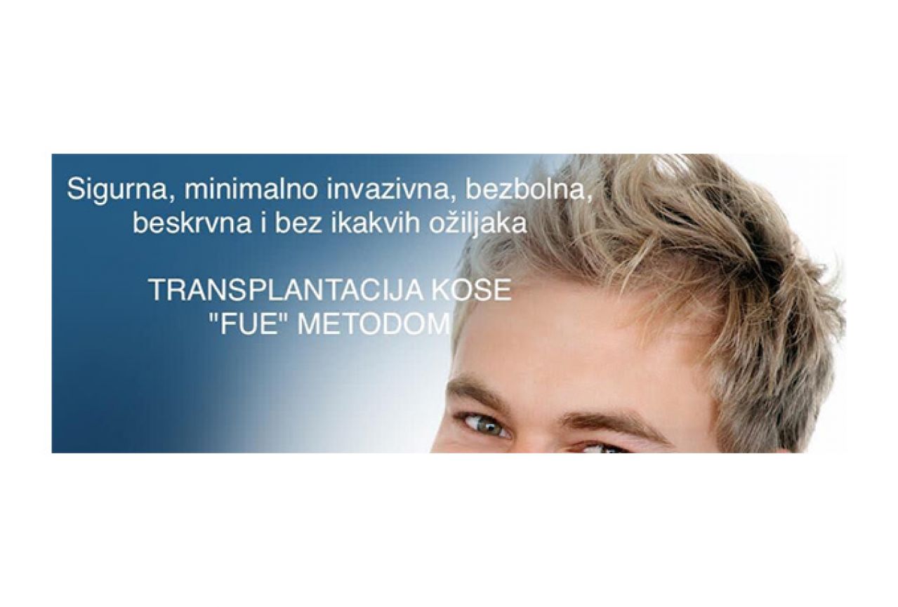 Transplantacija kose u Mostaru 