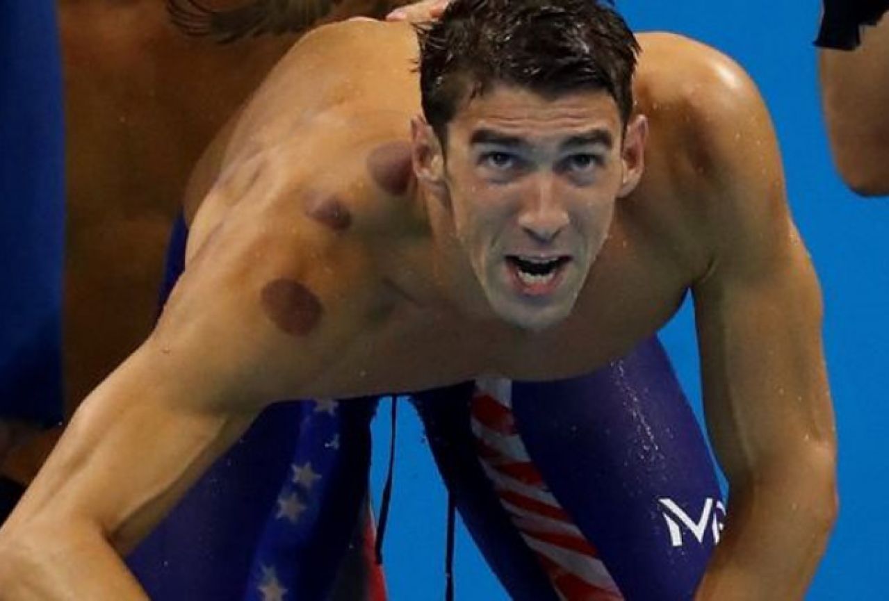 Zašto su tijela olimpijaca prekrivena velikim crvenim krugovima?