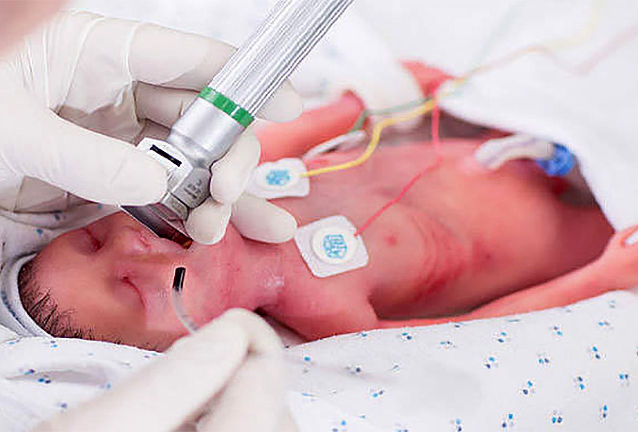 Razvijen novi simulator za prijevremeno rođene bebe