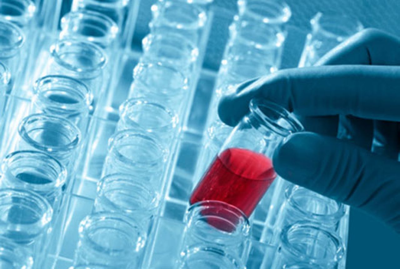 Znanstvenici: Analizom krvi moguće otkriti rak