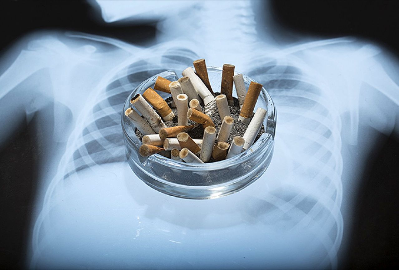 Kakve posljedice na vaše zdravlje ostavlja pušenje samo jedne kutije cigareta dnevno?