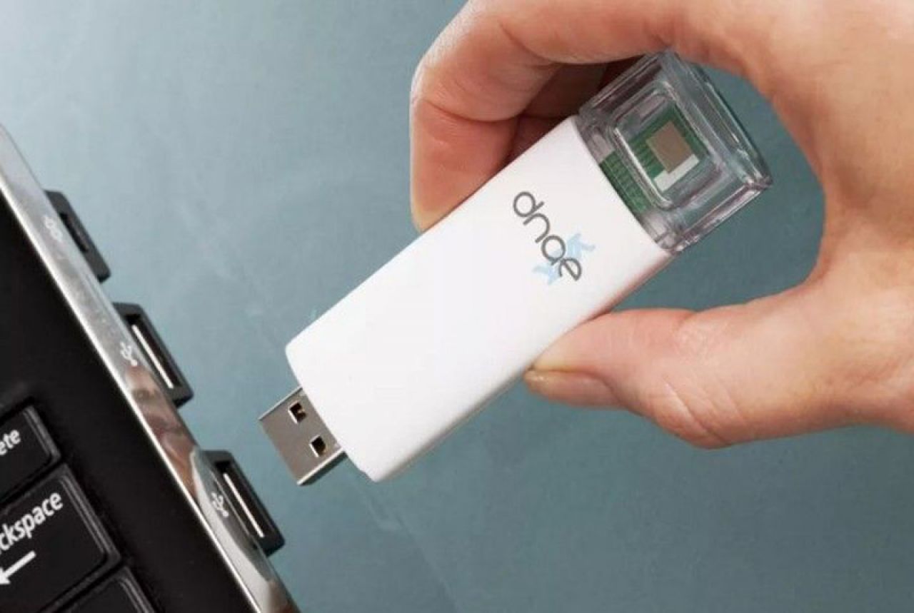 USB tester za prisutnost HIV-a u krvi