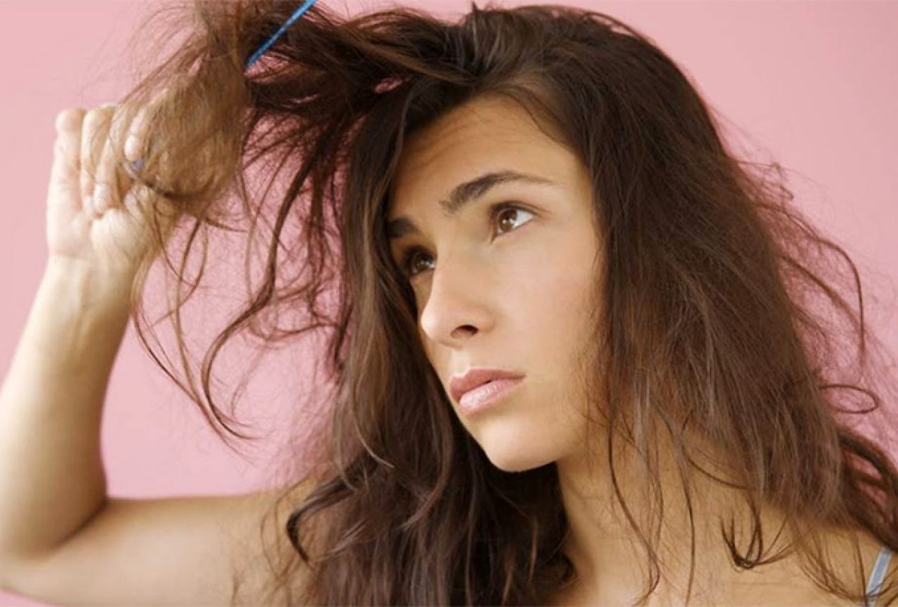 Kako spriječiti opadanje kose
