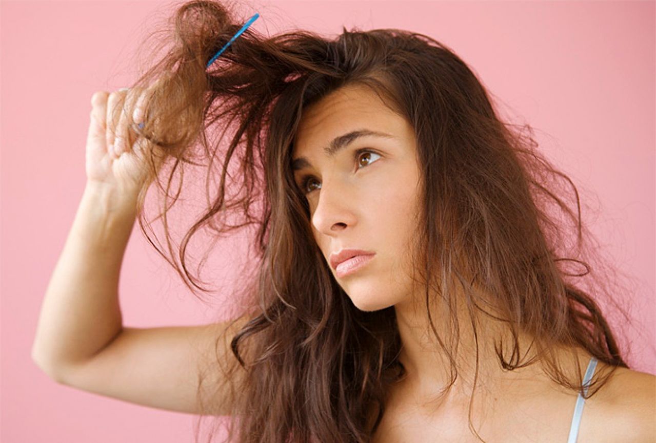 Što opadanje kose govori o vašem zdravlju