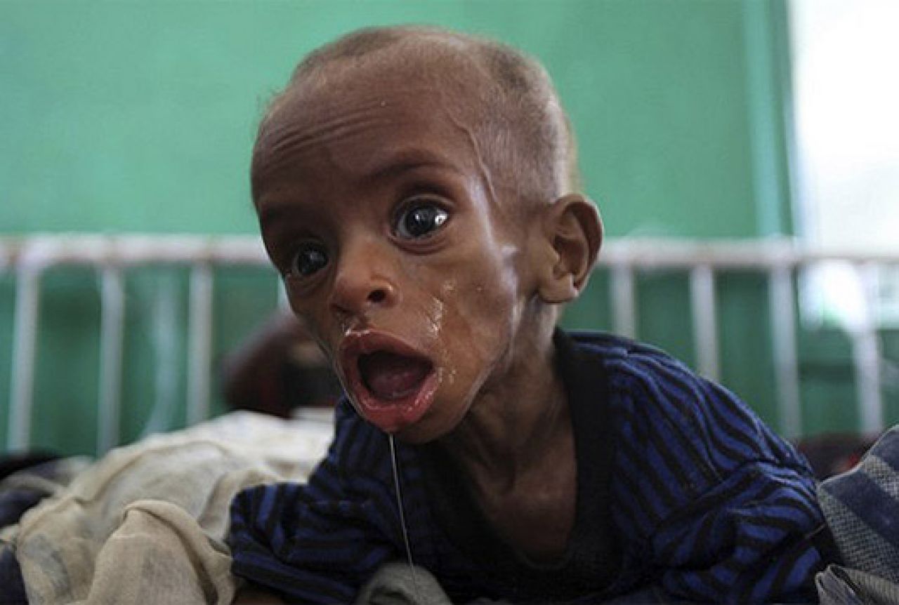 Ove godine u samo četiri zemlje od gladi će umrijeti 1,4 milijuna djece