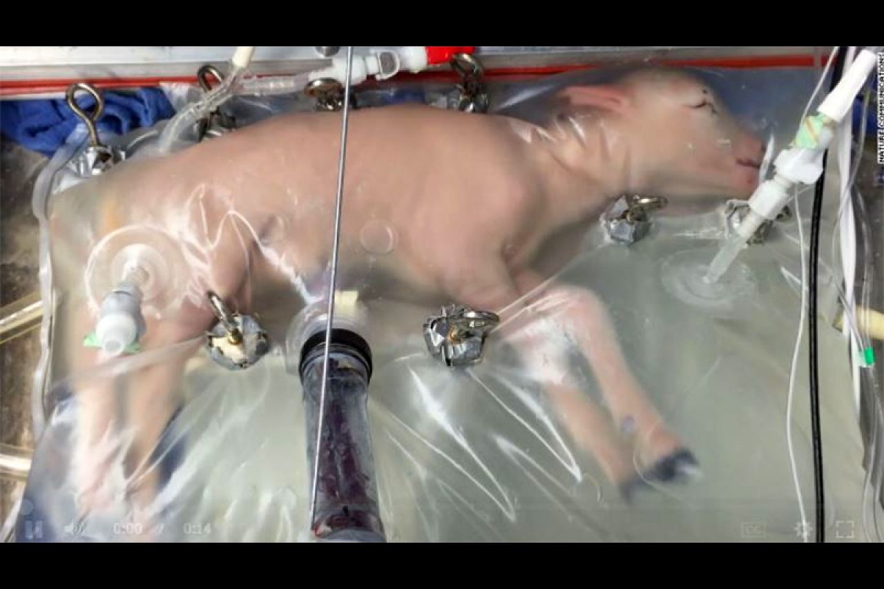 VIDEO | Znanstvenici napravili umjetnu maternicu