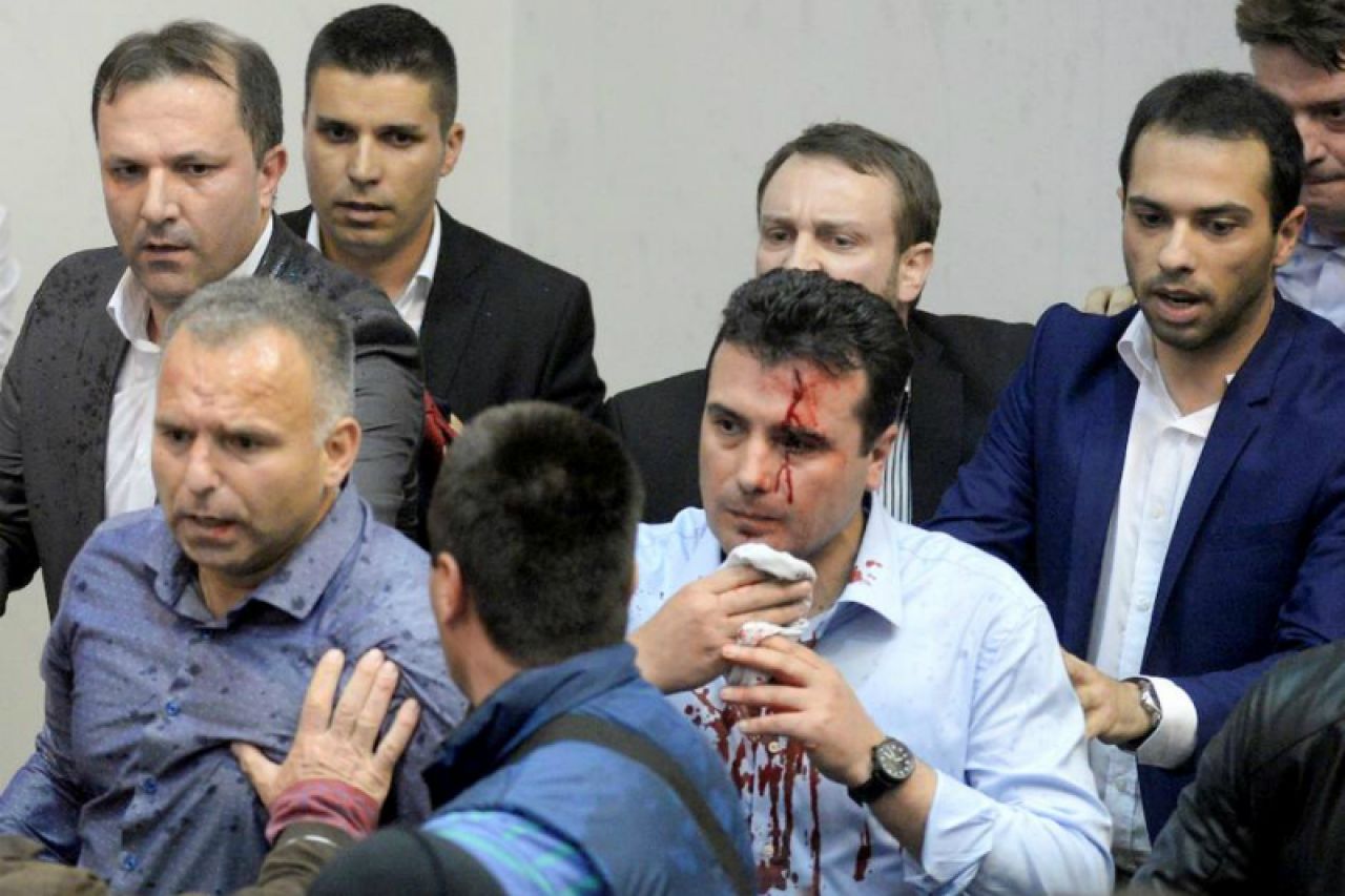 Više od 100 ljudi završilo u bolnici nakon krvoprolića u Skopju