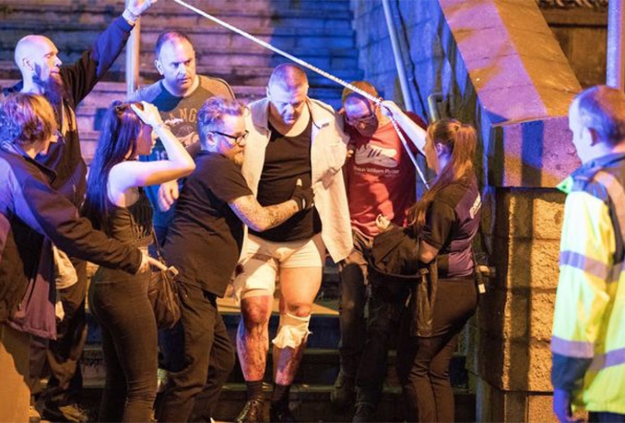 Nakon napada u Manchesteru 50 osoba i dalje u bolnici