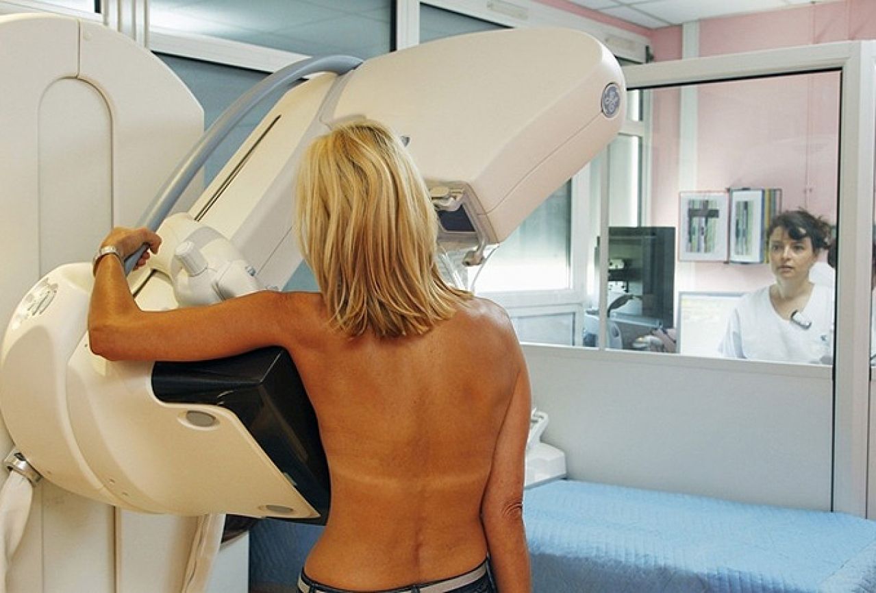 Nevladine organizacije kupile mamograf za svoje sugrađane