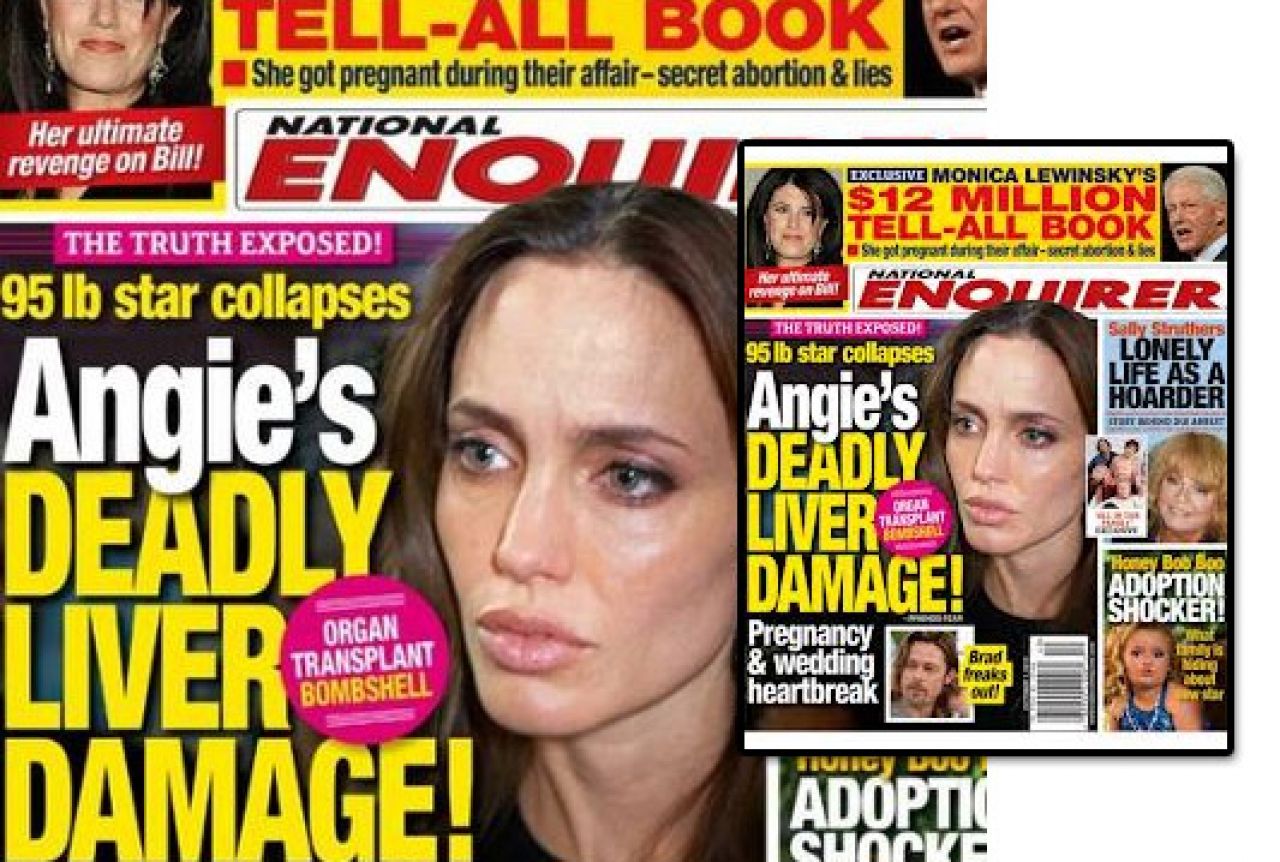 Angelina Jolie boluje od hepatitisa C i morat će na transplantaciju jetre?