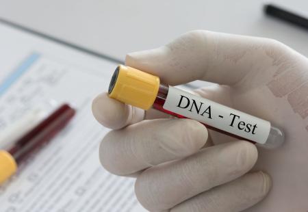 https://storage.bljesak.info/article/477633/450x310/DNA-test.jpg