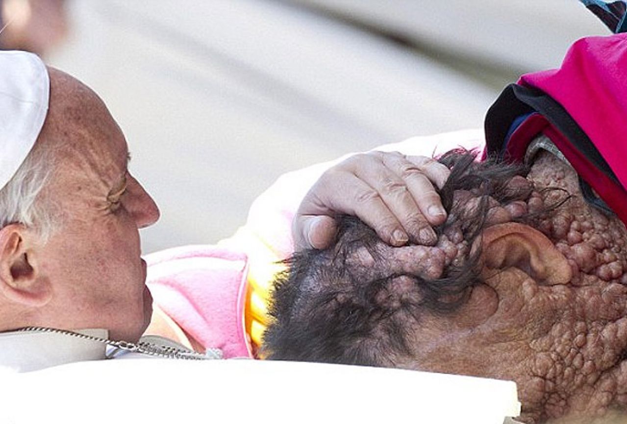 Papa stao i poljubio bolesnog čovjeka prekrivenog čirevima