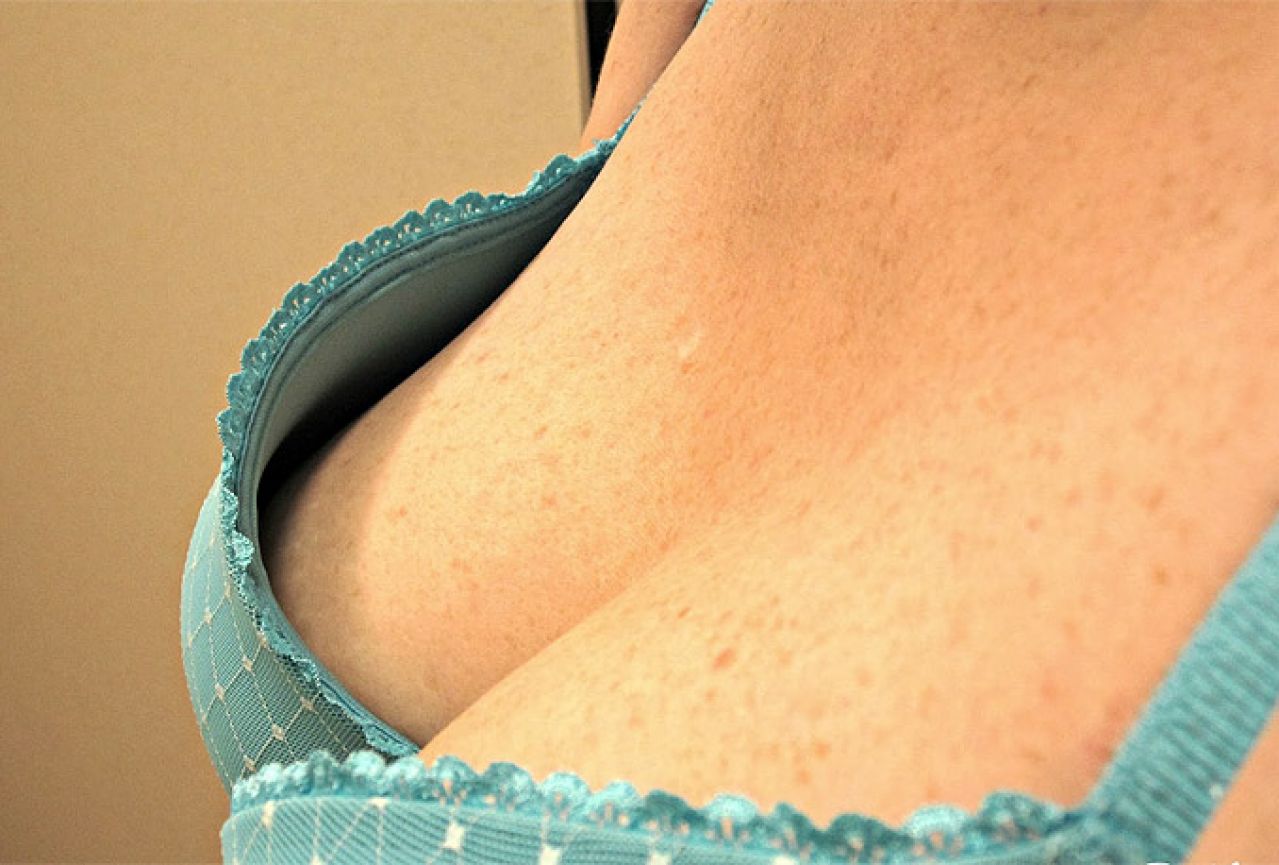 волосы на сосках на груди у женщин фото 43