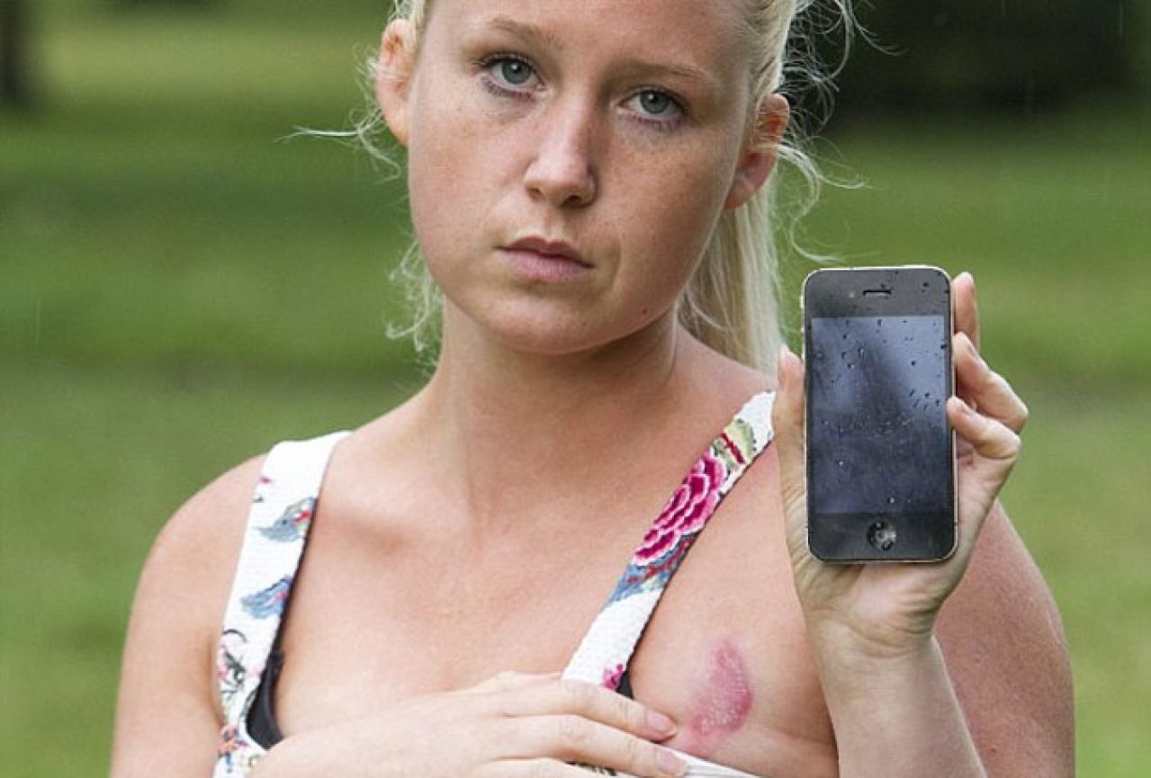 Britanku spržio iPhone dok je spavala
