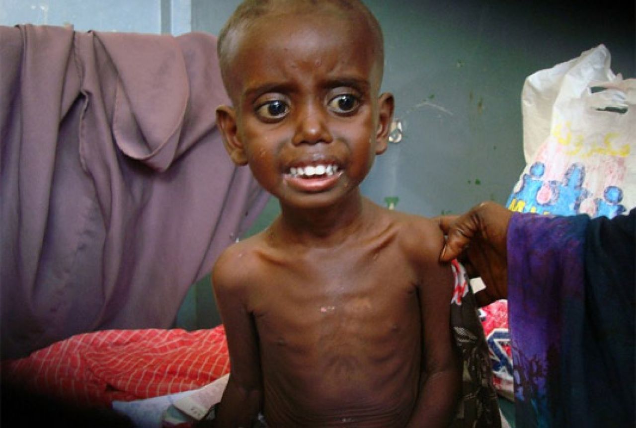UN nema više hrane: Stotine tisuća djece u opasnosti da umre od gladi