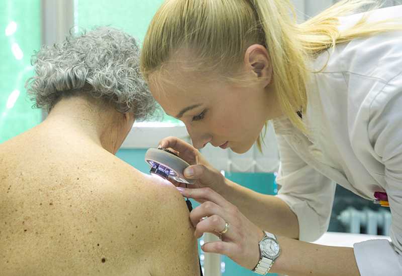 Bljesak.info - Bosna i Hercegovima ima problem sa karcinomom kože