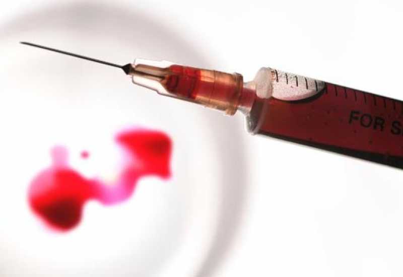 Novi test krvi detektira rak godinama prije pojave bolesti