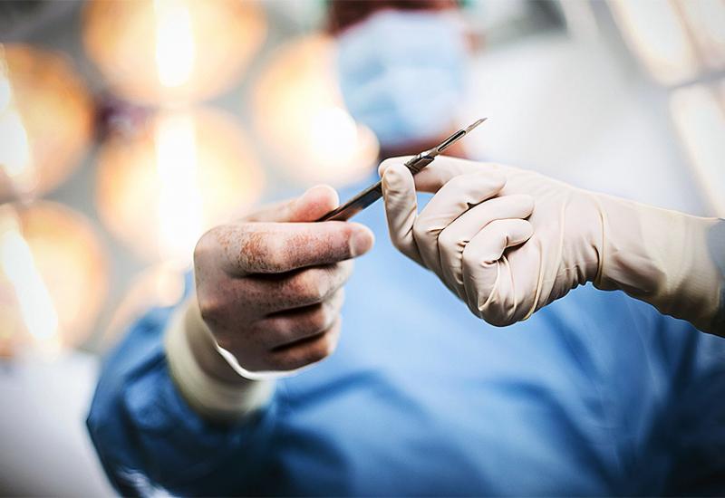 Kirurg laserom pisao svoje inicijale na transplantiranim jetrama