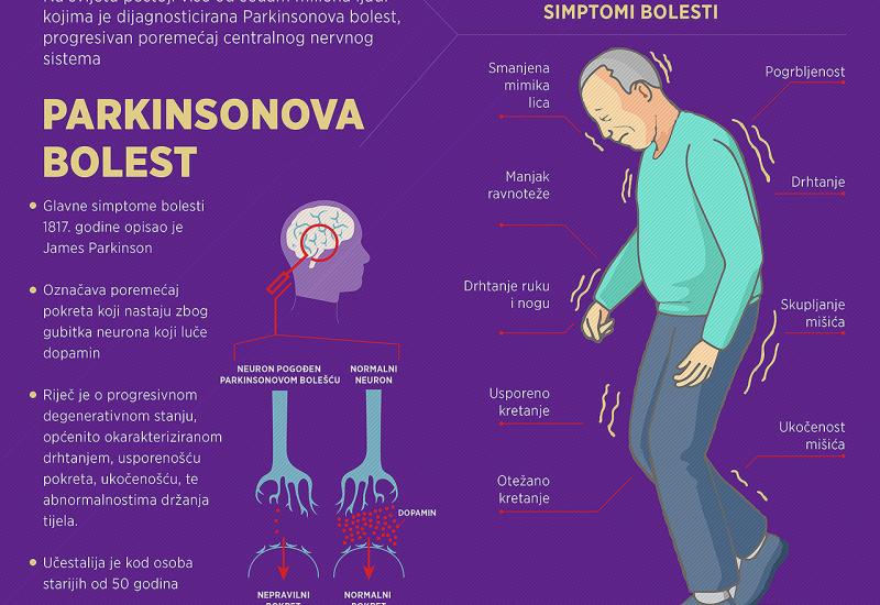 Širom svijeta više od sedam milijuna oboljelih od Parkinsonove bolesti