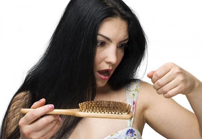 Opadanje kose - 6 znakova koji otkrivaju manjak cinka u organizmu
