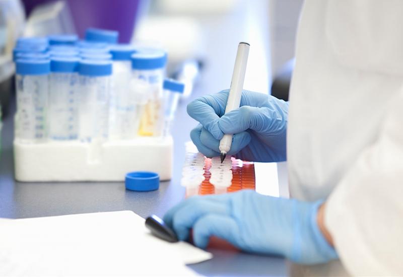 Potražnja za testovima na koronavirus nadmašuje kapacitete farmaceutskog sektora