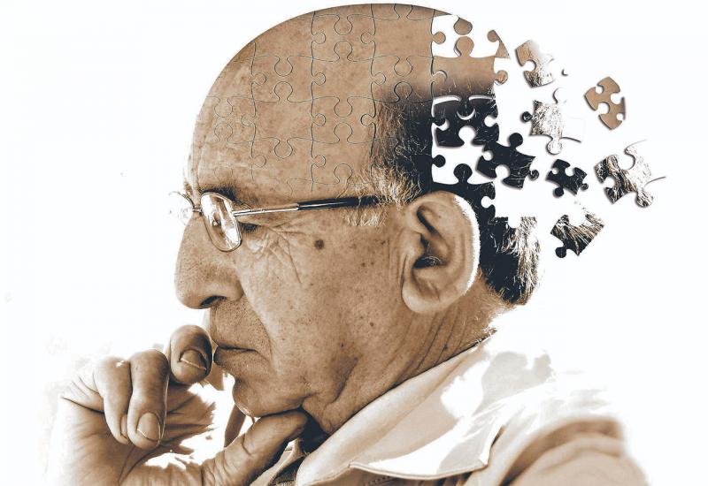 Svjetski dan Alzheimera – Što znate o ovoj bolesti