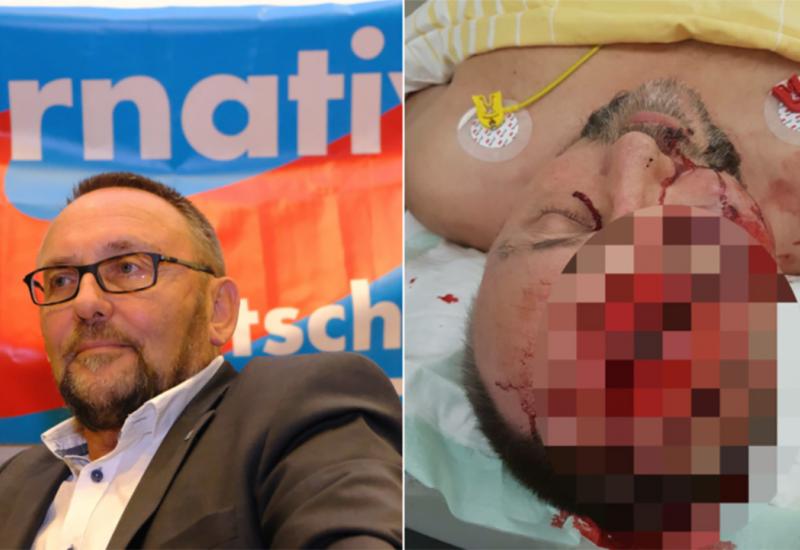 Lokalni lider radikalno desničarske partije Alternative fur Deutschland -  Lokalni lider AfD-a teško ozlijeđen u napadu u Bremenu