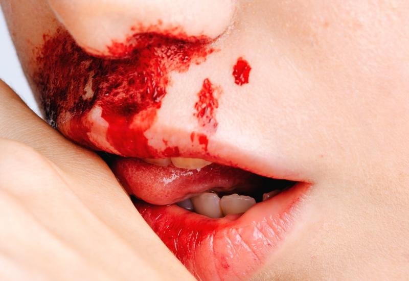 Vampirske metode: Bogataši ostaju mladi 'gosteći' se krvlju mladih