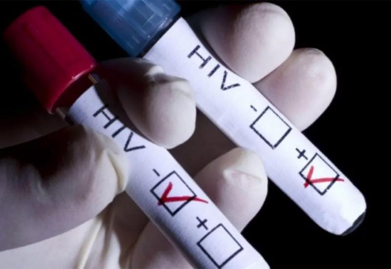 ''Svaka mogućnost da uništavamo HIV veliki je pomak za čovječanstvo''
