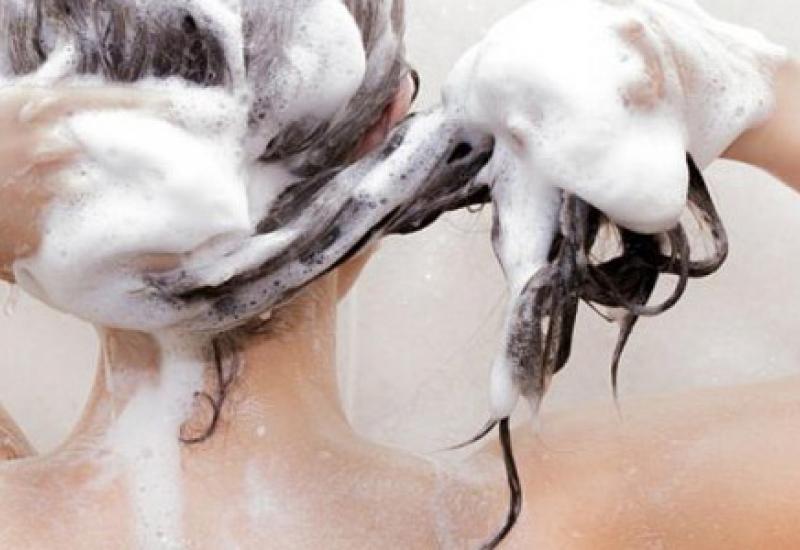 Provjerite jeste li alergični na svoj šampon i napravite domaći 