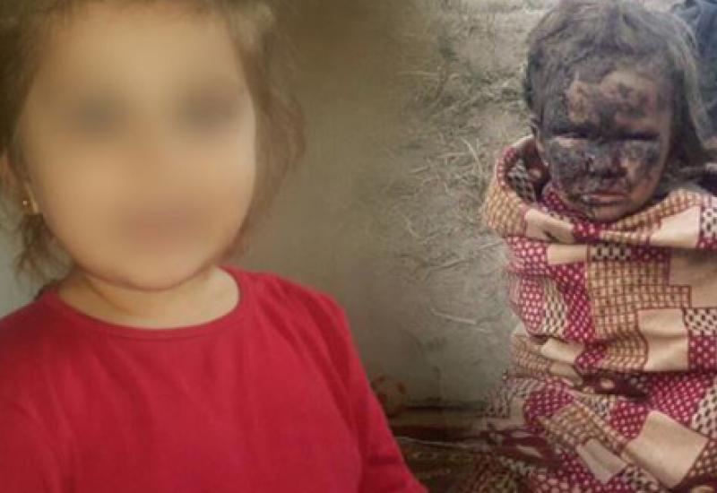 Na lijevoj strani fotografija Iman koju je njena majka Ilda poslala nani Samri krajem 2018. godine, a na desnoj fotografija djevojčice za koju je više izvora reklo da je Iman nakon što je povrijeđena tijekom oslobađanja Baguza od militanta IS-a. - Mala Bosanka među nevidljivom djecom 