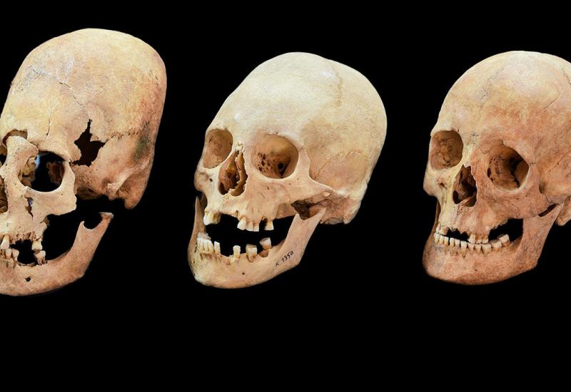 Pronađena lubanja stara 2.200 godina s 'neurokirurškom' rupom 