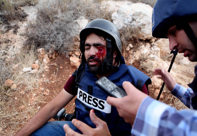 Snajperist pogodio novinara u oko