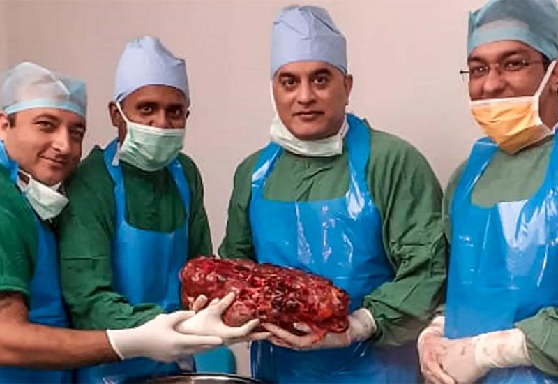 Najveći bubreg koji je uklonjen u Indiji - Liječnici uklonili bubreg težak 7,4 kilograma