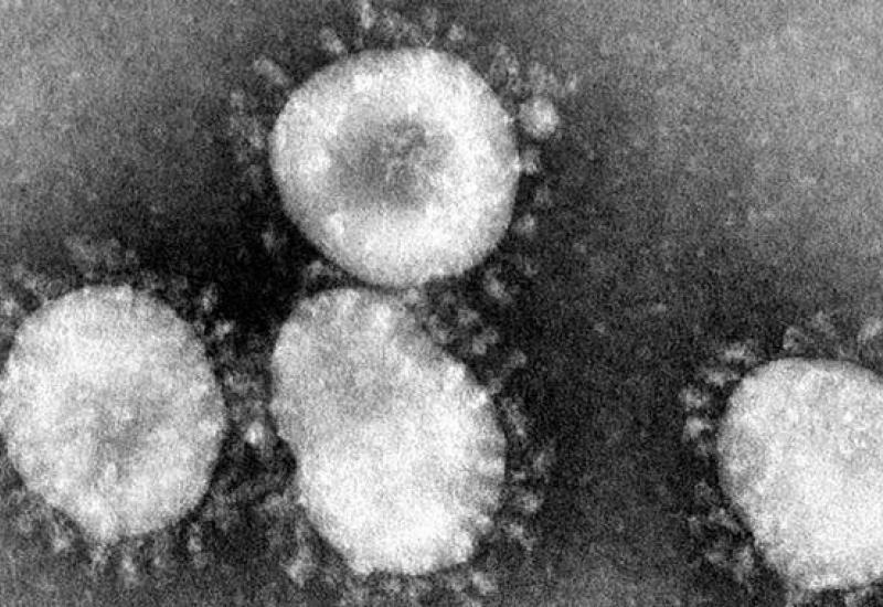  Što je poznato u vezi s ovoim novim virusom? - SARS – nova globalna zdravstvena opasnost?