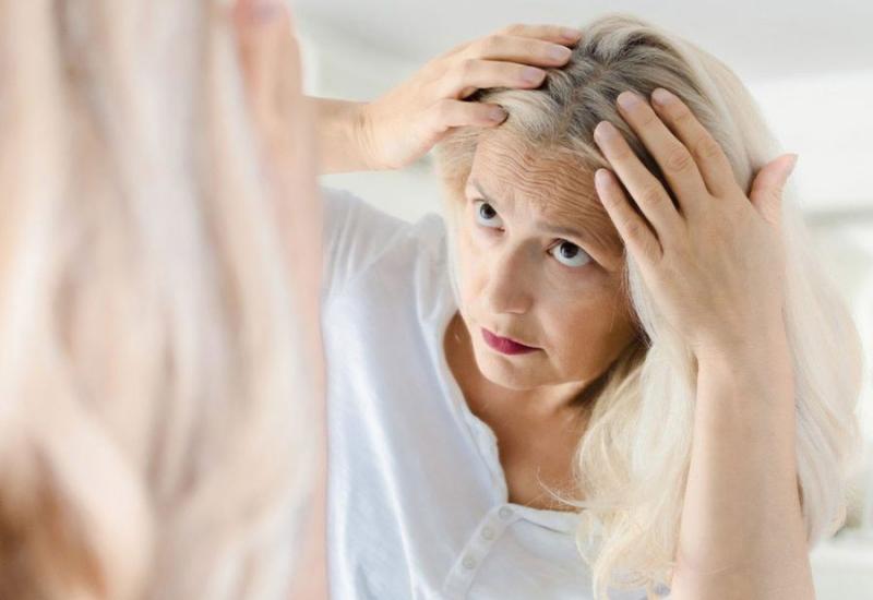 Znanstvenici otkrili zašto kosa posijedi zbog stresa