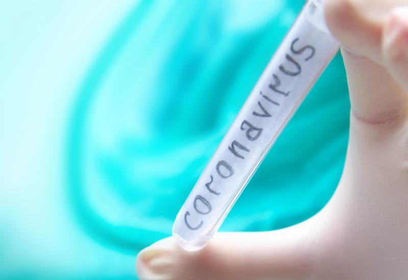 Stručnjaci se sastaju da odrede smjer istraživanja lijeka protiv Coronavirusa