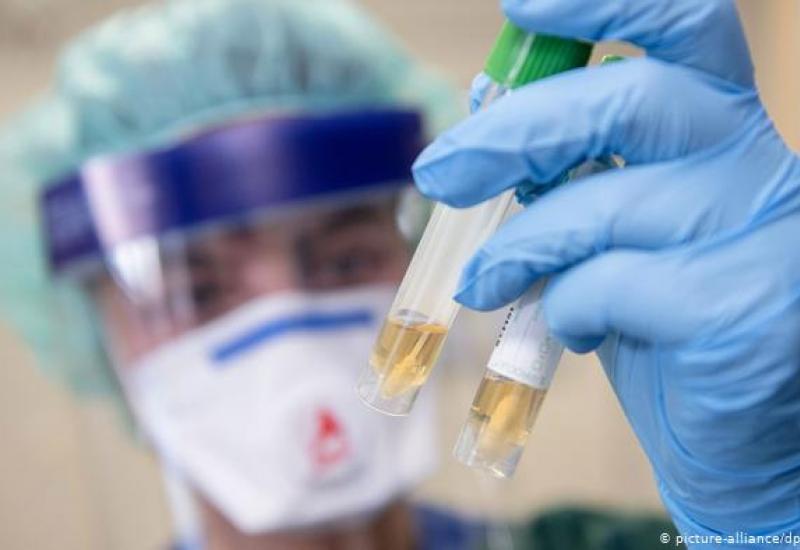 Testiranje na koronavirus besplatno, očekuje se isporuka 25.000 testova u RS