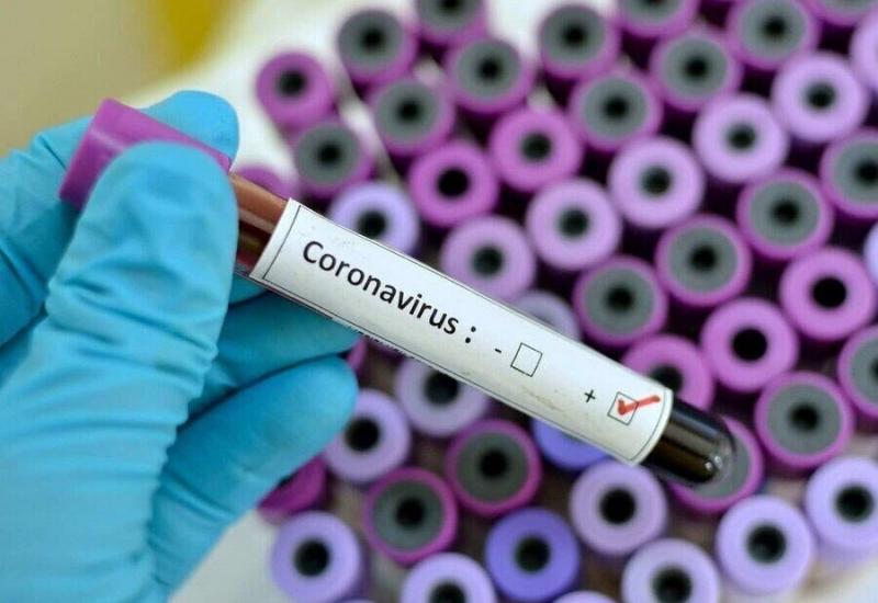 Negativni svi uzorci testirani u RS na virus korona